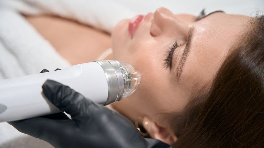 Esthetician using an RF microneedling device like Morpheus8 for skin tightening