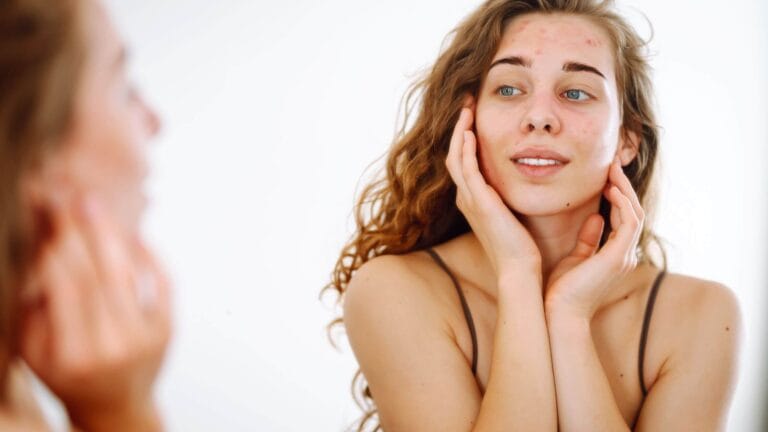 Over exfoliated skin showing redness, irritation and damaged skin barrier