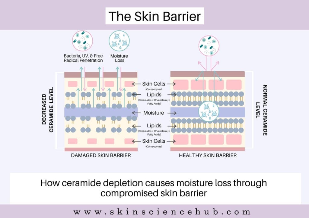 how ceramides depletion cause moisture loss through compromised skin barrier