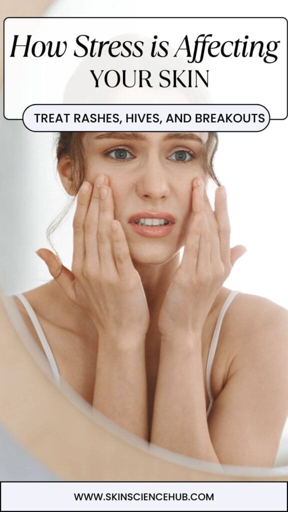 Can Stress Cause Skin Rashes, Spots and Breakouts?