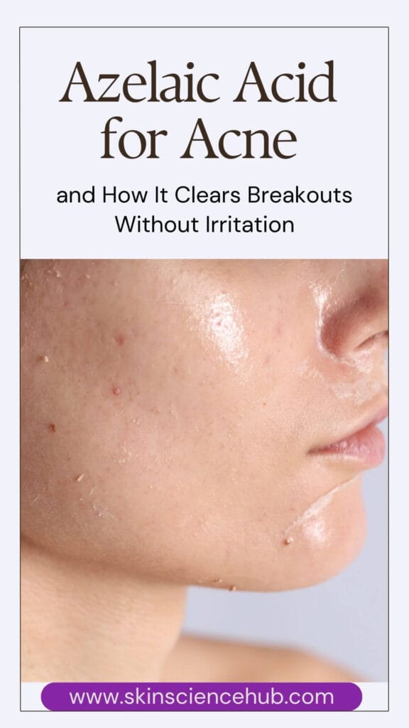 Azelaic Acid for Acne and How It Clears Breakouts Without Irritation