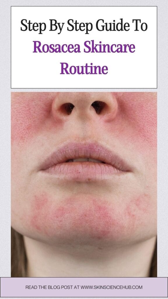 How to Build a Rosacea Skincare Routine Step by Step