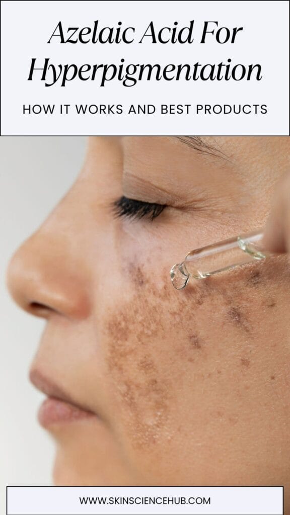 Azelaic Acid for Hyperpigmentation, Melasma and PIH