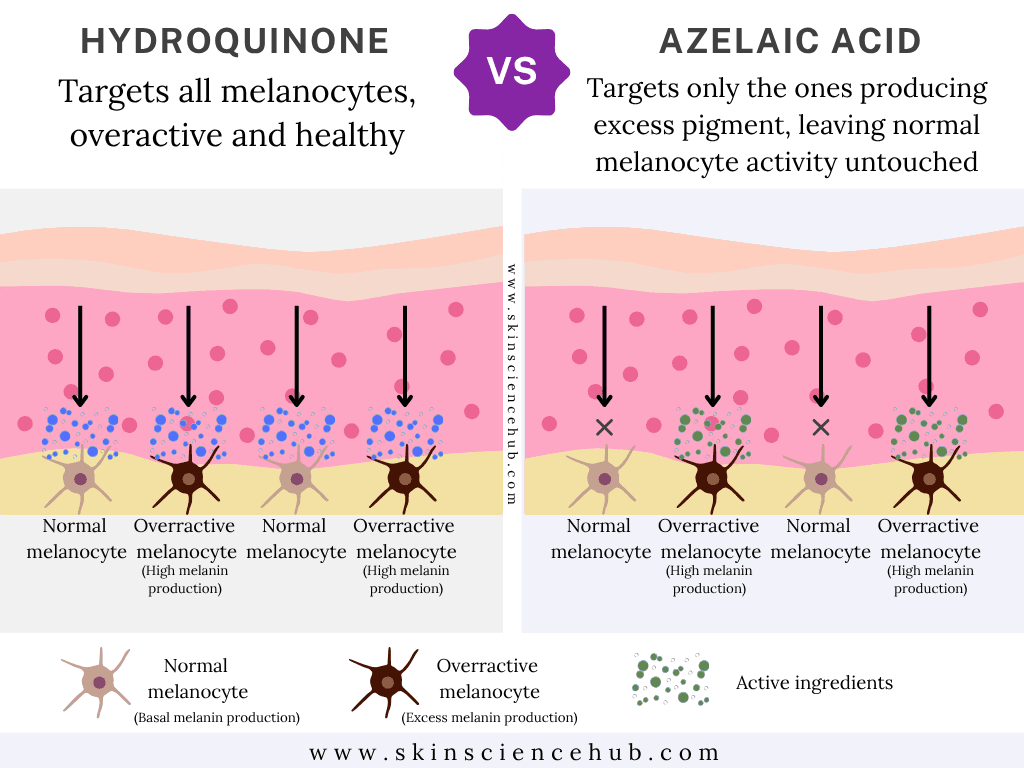 Azelaic Acid vs Hydroquinone for Hyperpigmentation, Dark Spots and Melasma