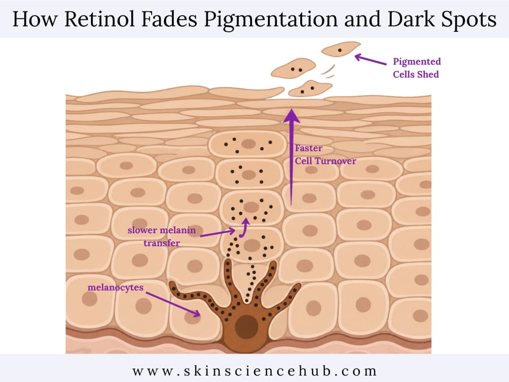 How Retinol Fades Pigmentation and Dark Spots (1)