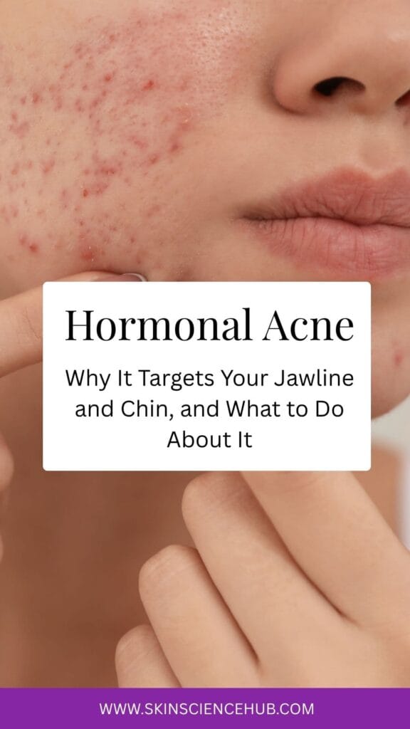 Hormonal Acne: Why It Targets Your Jawline and Chin, and What to Do About It