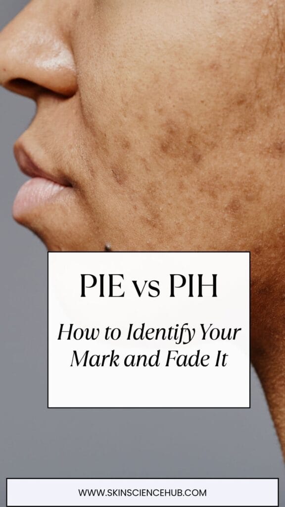 PIE vs PIH: How to Identify Your Mark and Fade It