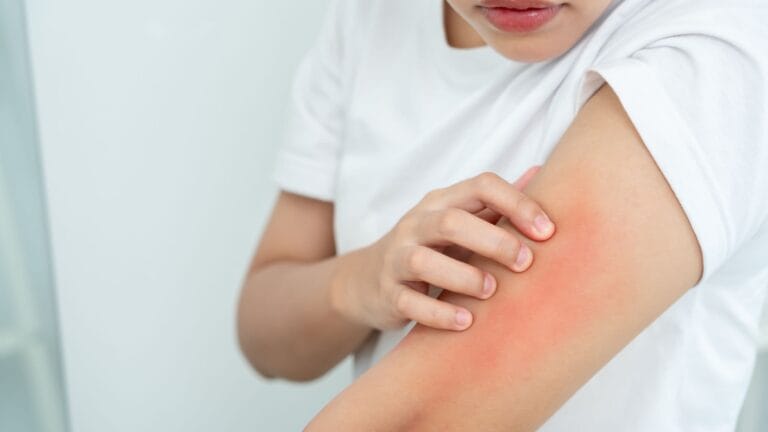 That Rash You Can’t Explain? Your Skincare’s Fragrance Might Be to Blame