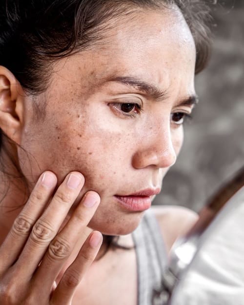 skin conditions